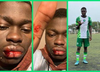 Like Didier Drogba warned, Nigerian starlet Moses Jerry beaten by fake Serbian football agent — The Full story